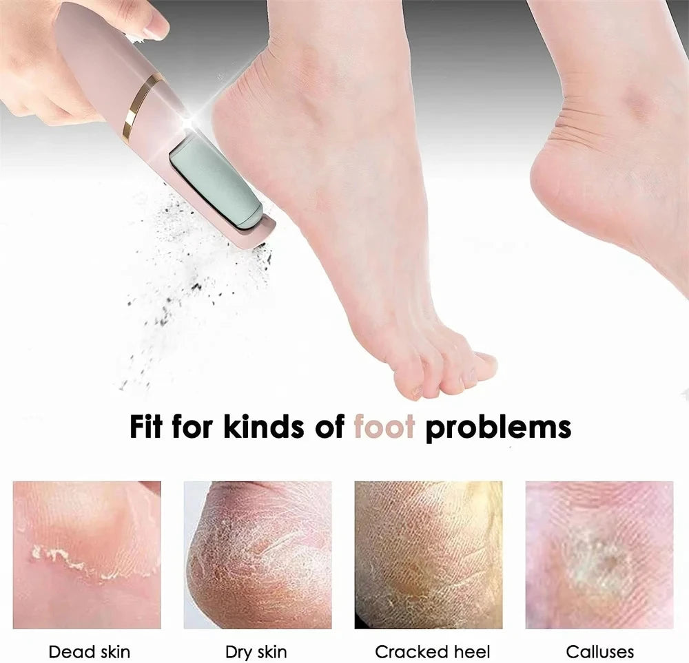 SmoothFeet Electric Callus Remover